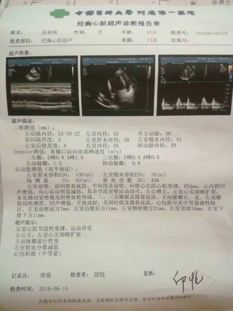 口腔溃疡式弥漫大B淋巴瘤-淋巴瘤之家