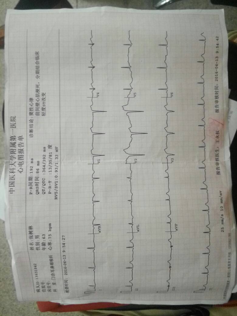 口腔溃疡式弥漫大B淋巴瘤