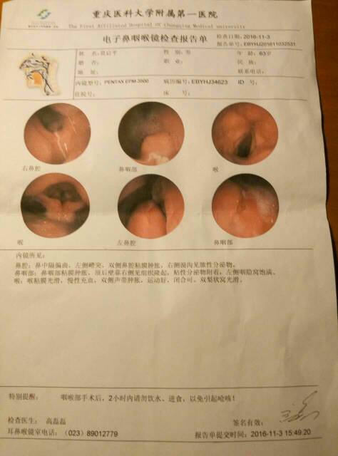 是不是转移了?-淋巴瘤之家