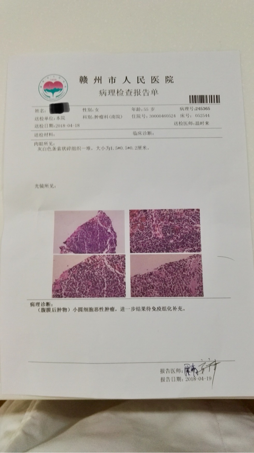 今天拿到病理报告弥漫大b可能误诊吗是否需要其他医院再做病理确认呢