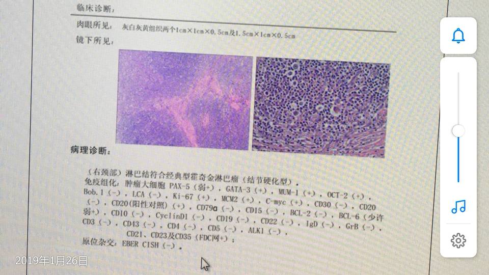 各位帮忙看看这个免疫组化的结果