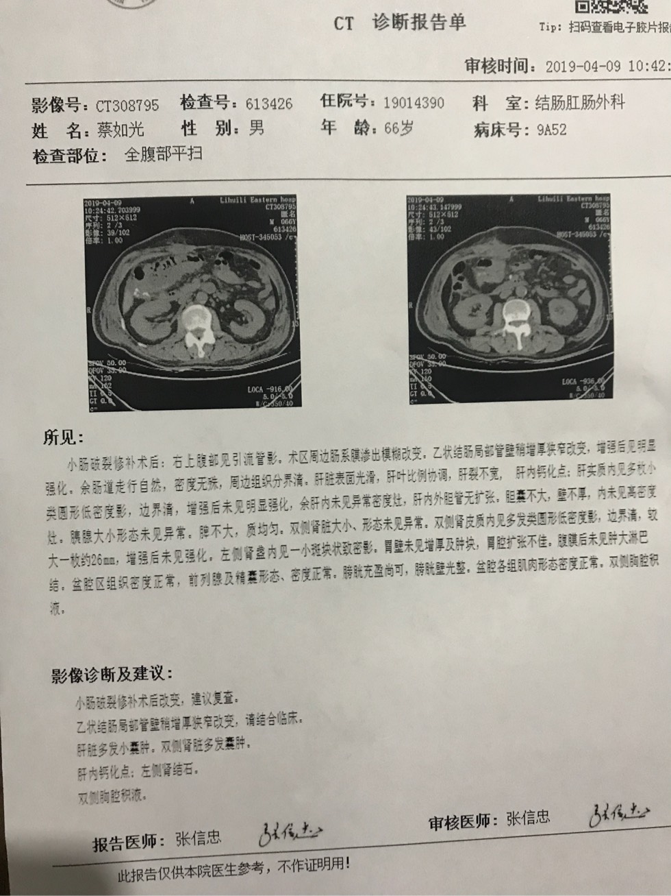 请大家帮帮我肠穿孔后伤口无法愈合怎么办