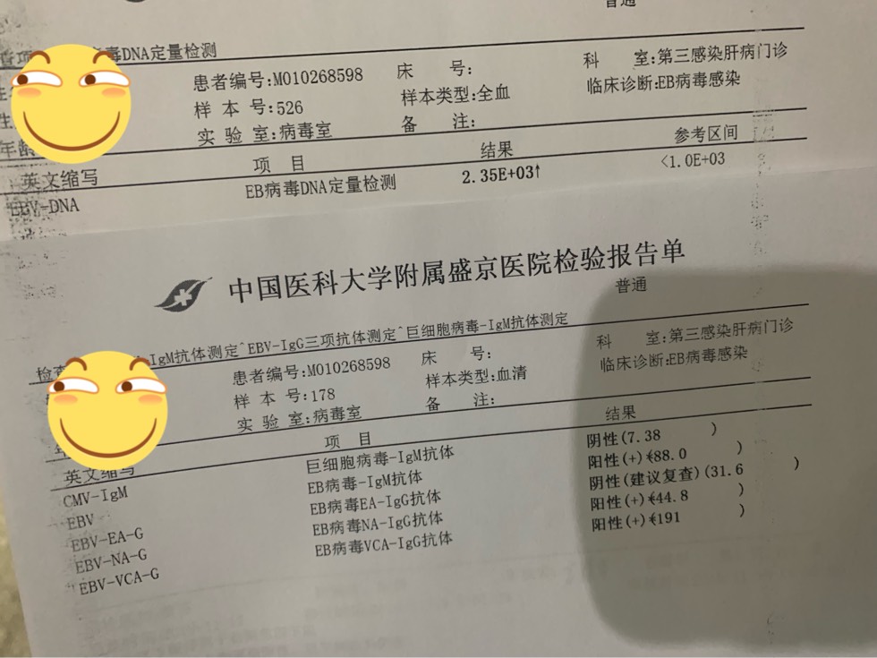 有没有懂慢性eb病毒感染的