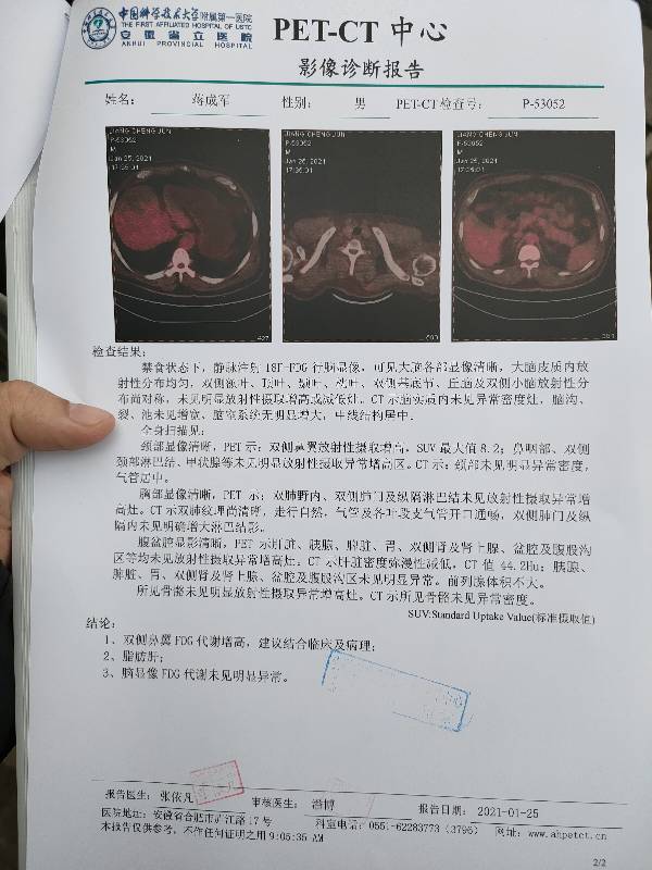 请问大家这个petct结果怎样样确诊nkt这个几期