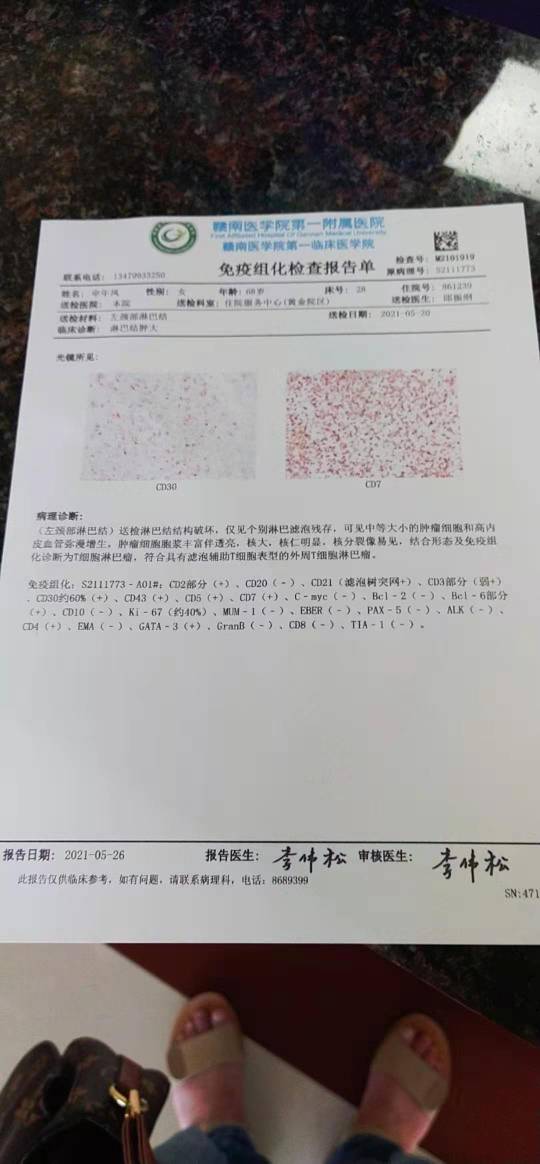 免疫组化报告图片图片