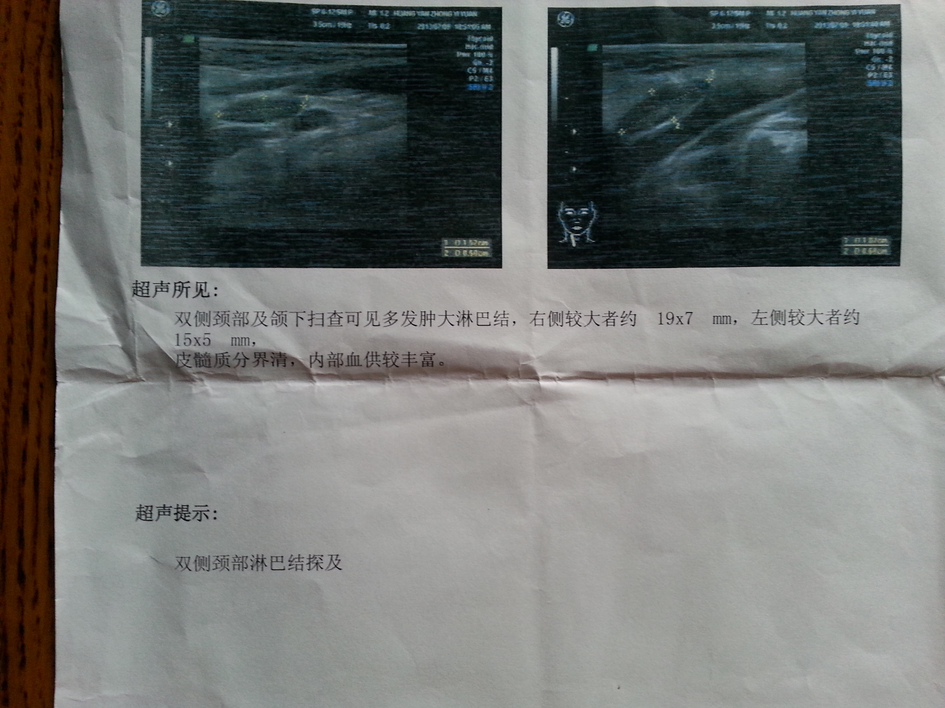 7月31号颈部B超