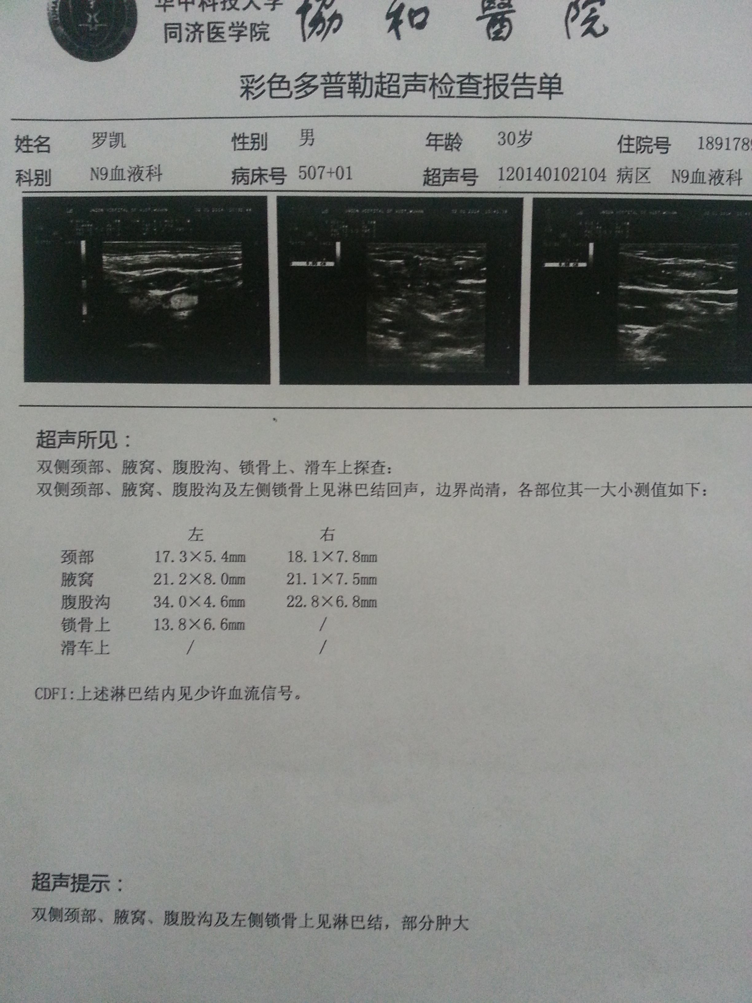 复查彩超结果