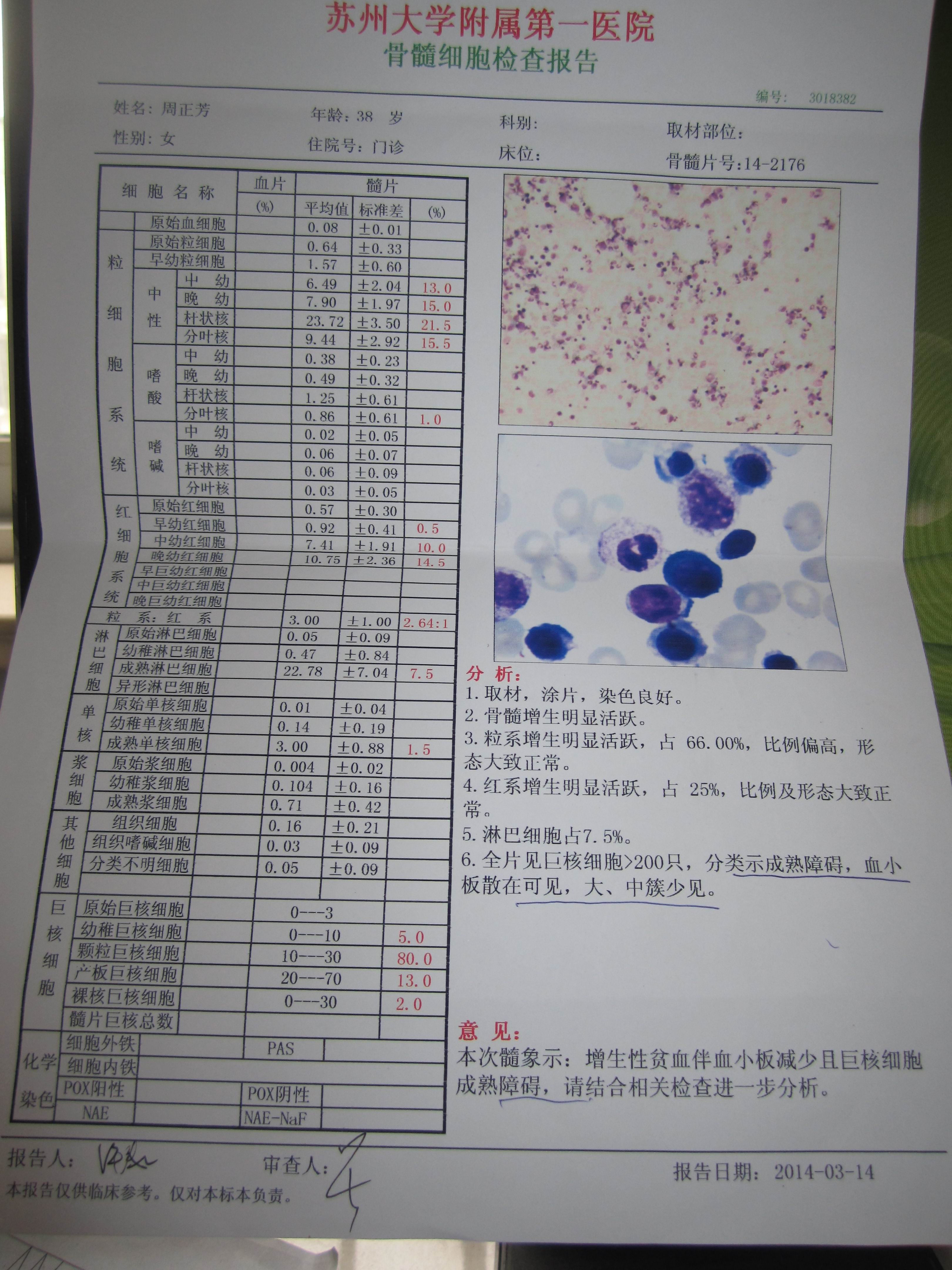 骨髓报告