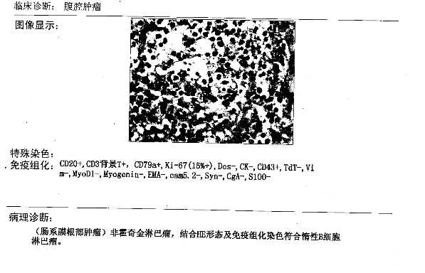 病理检查报告单