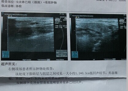 QQ图片20140605093441.jpg