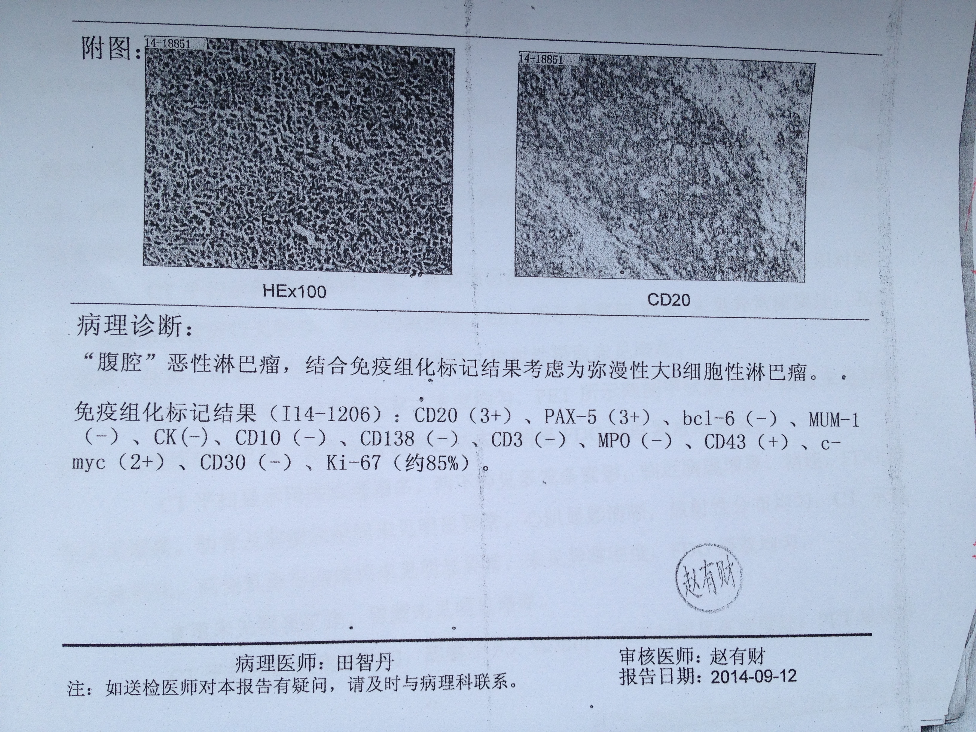 免疫组化