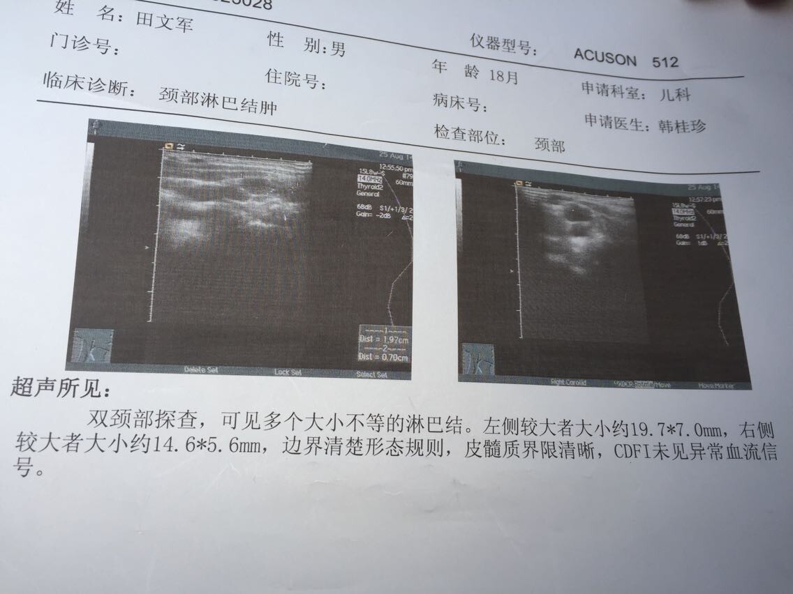 这个是半年前孩子一岁半的时候的彩超单子