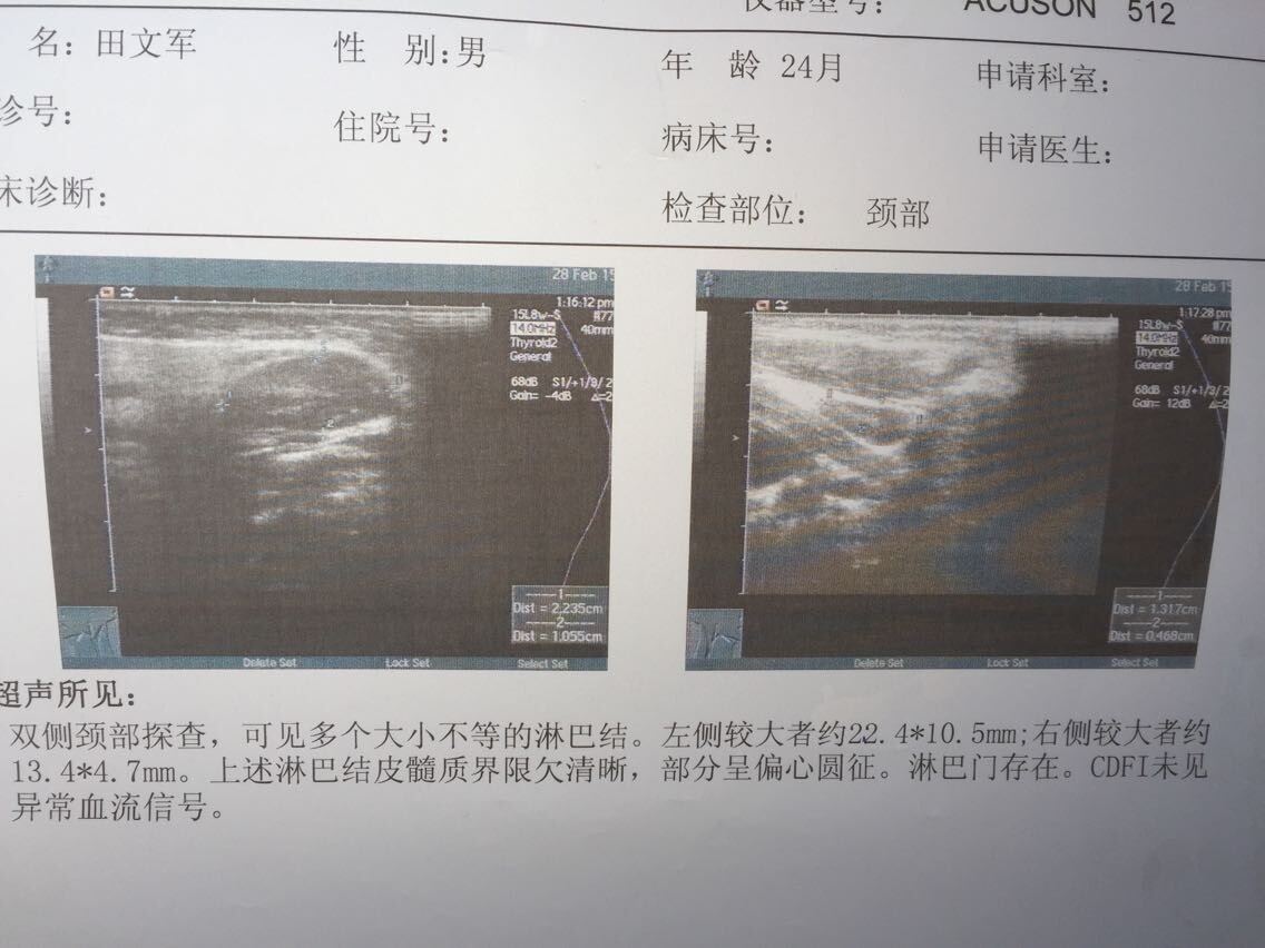 这个是最近拍的彩超单子