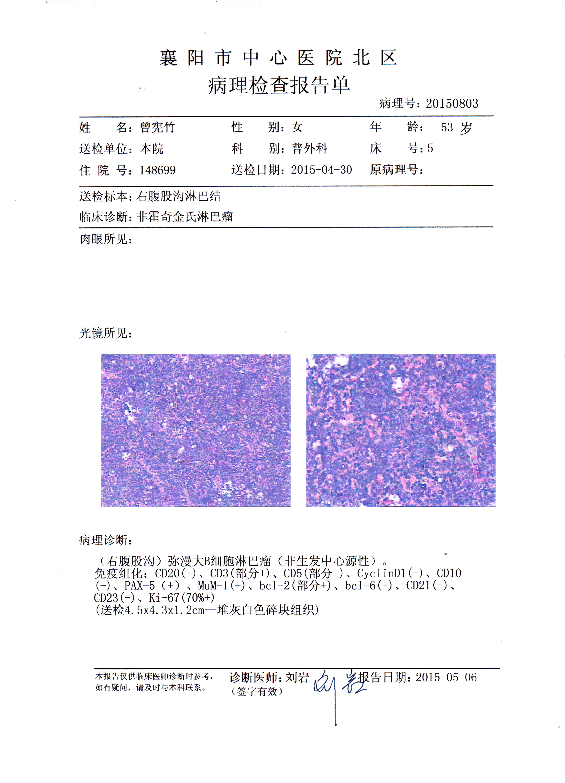 襄阳医院病理报告.jpg