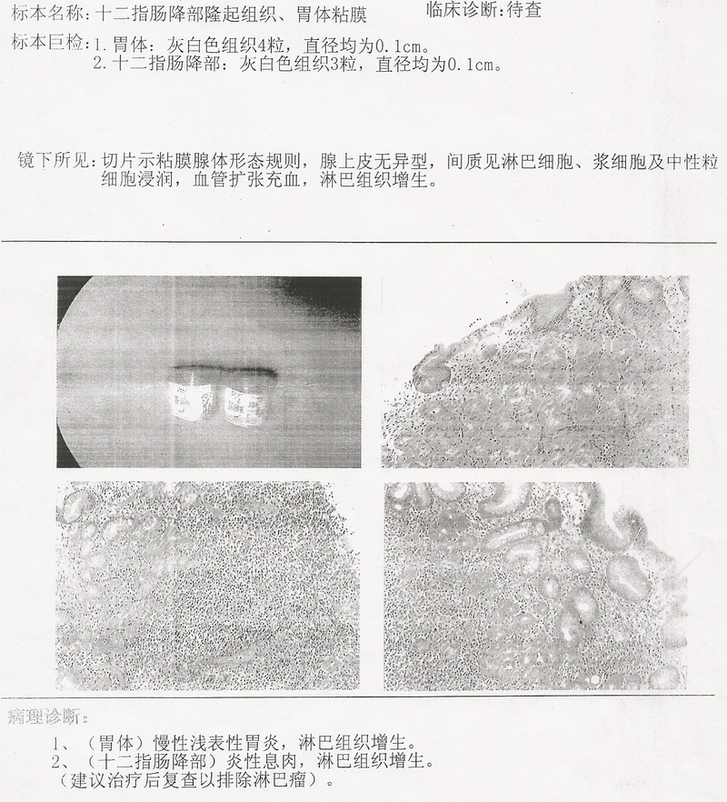 1503胃病理.jpg