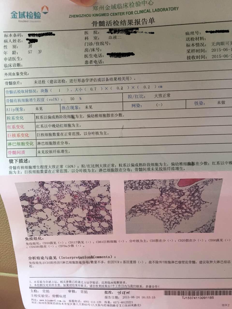 骨髓活检报告