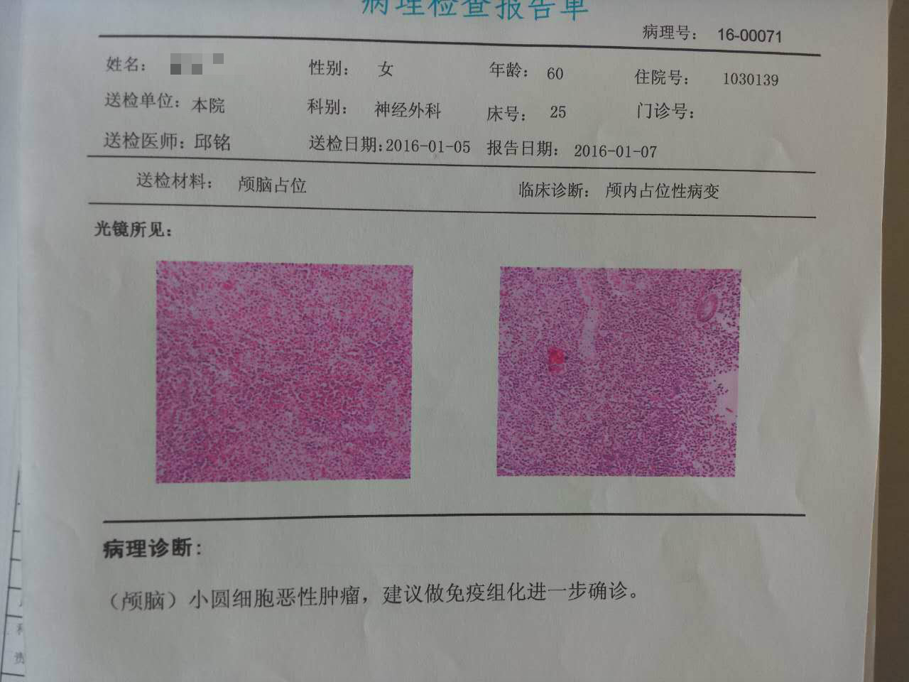 病理分析