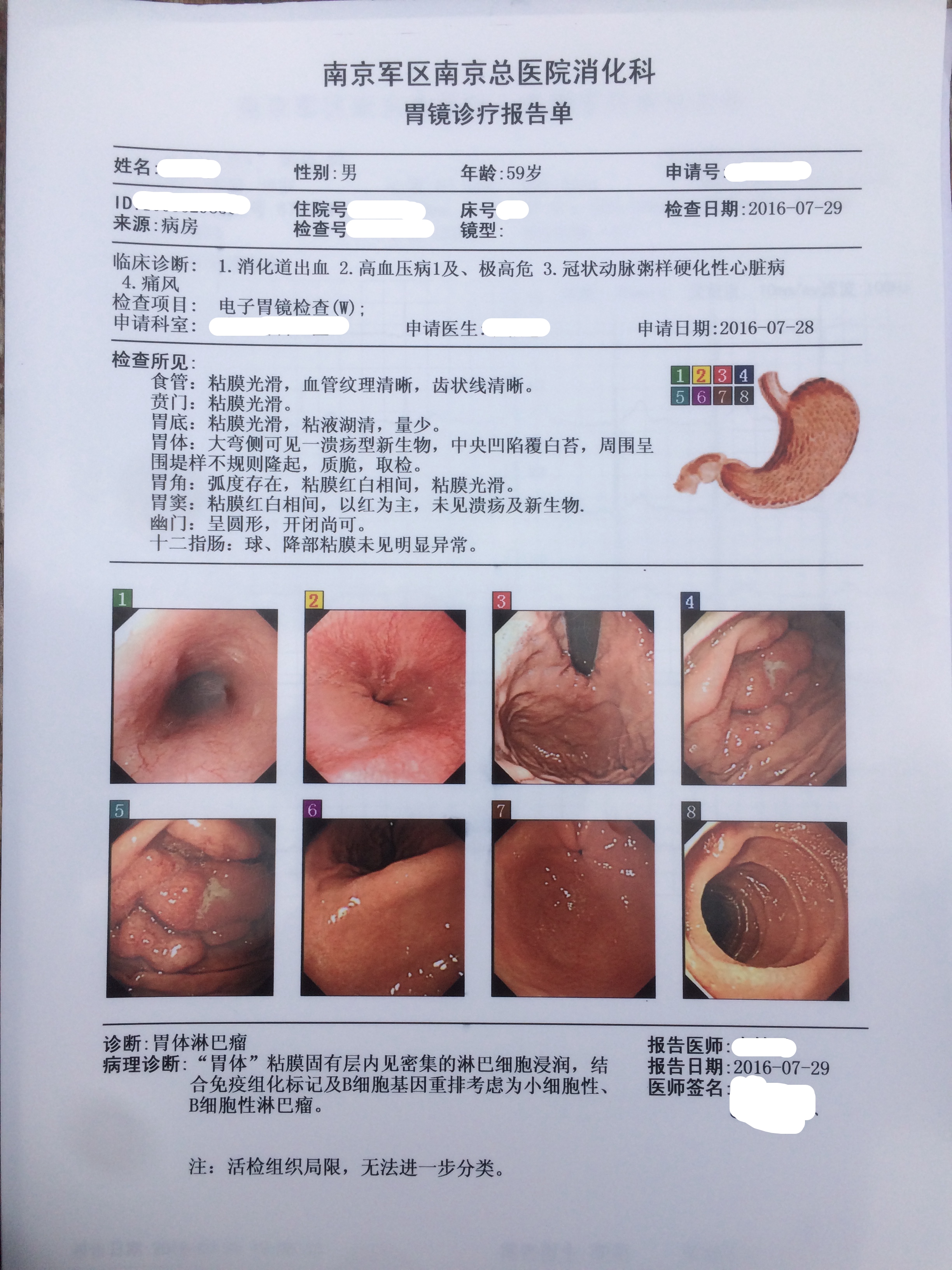 胃镜诊断报告