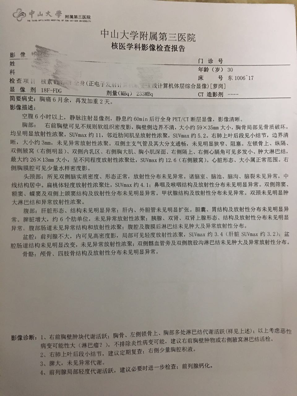 4疗后增强CT