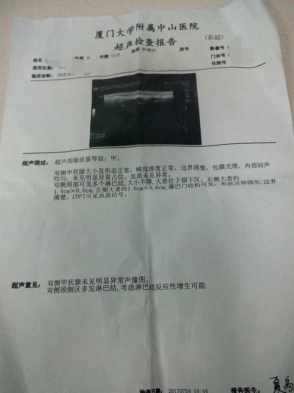 第二次B超报告单