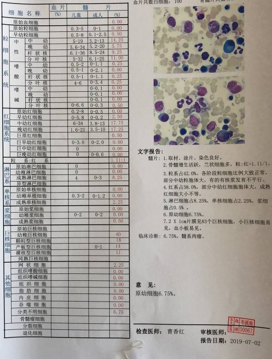 骨穿結果報告不一致大家幫忙看看