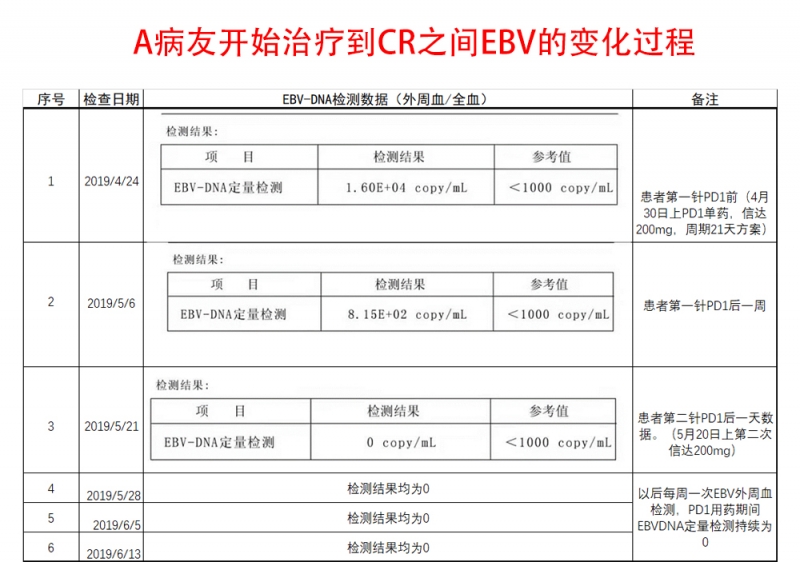 病友A ebv.jpg