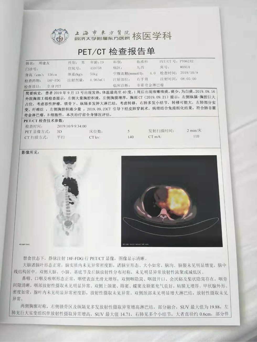 petct檢查求分析急