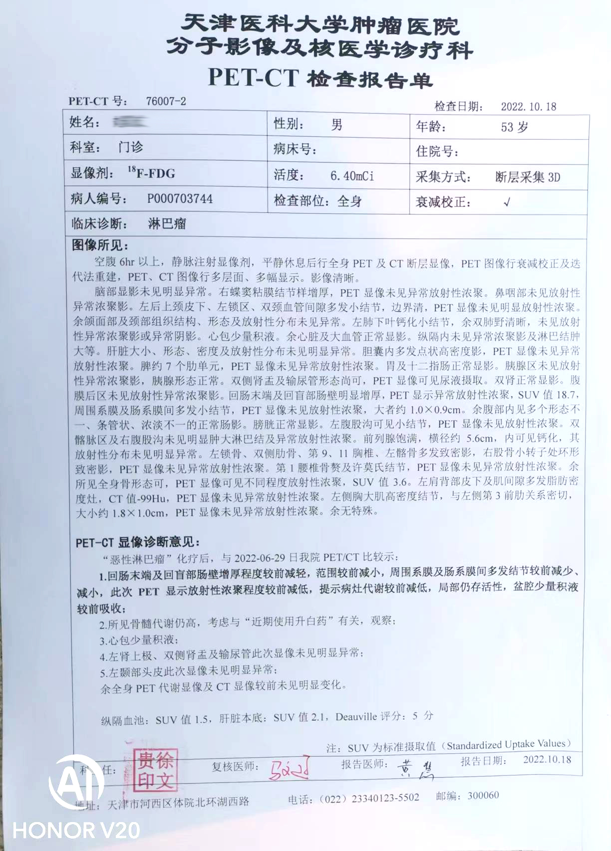 确诊时petct