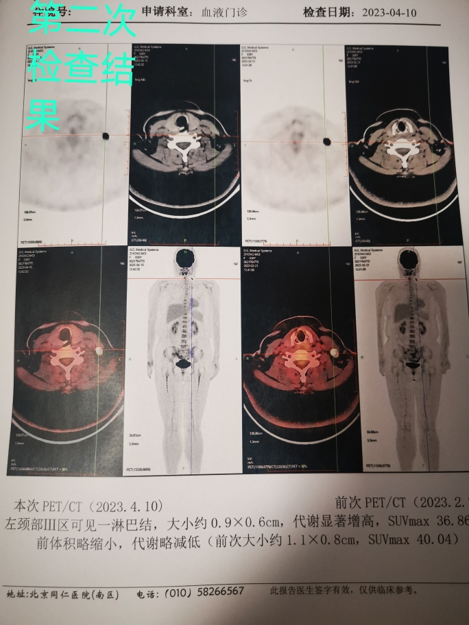 第二次petct检查残留位置