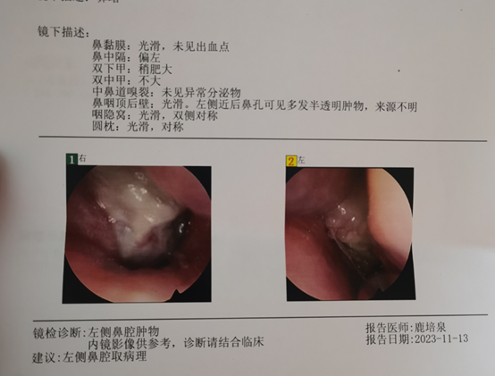 第一次鼻咽镜