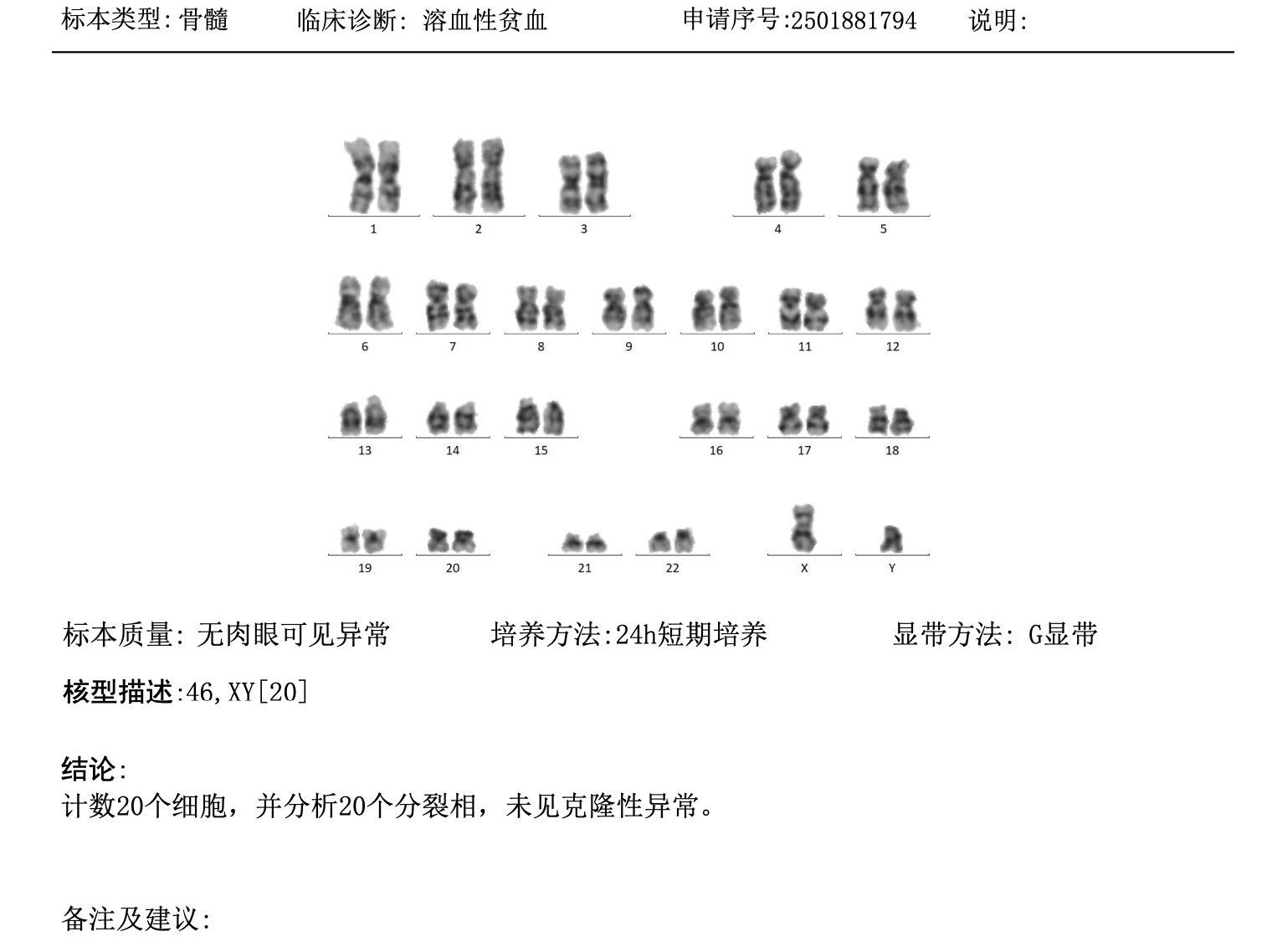 染色体检查-[骨髓].png